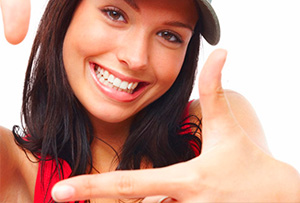 invisalign