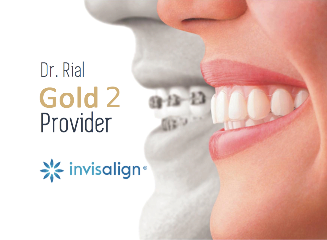 invisalign invisalign